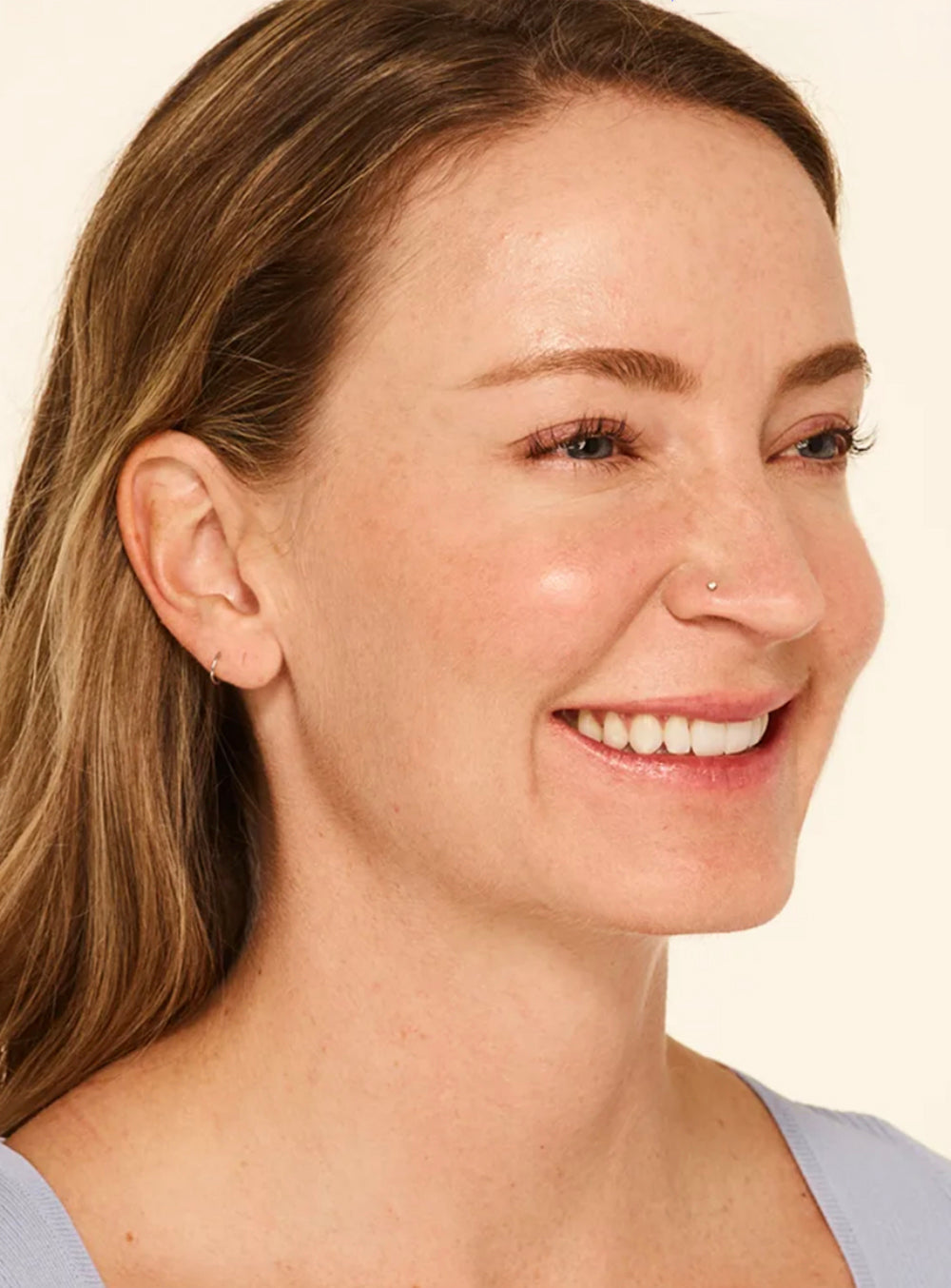 After wrinkle relaxer treatment showing smoother skin and reduced fine lines in St. Augustine, FL