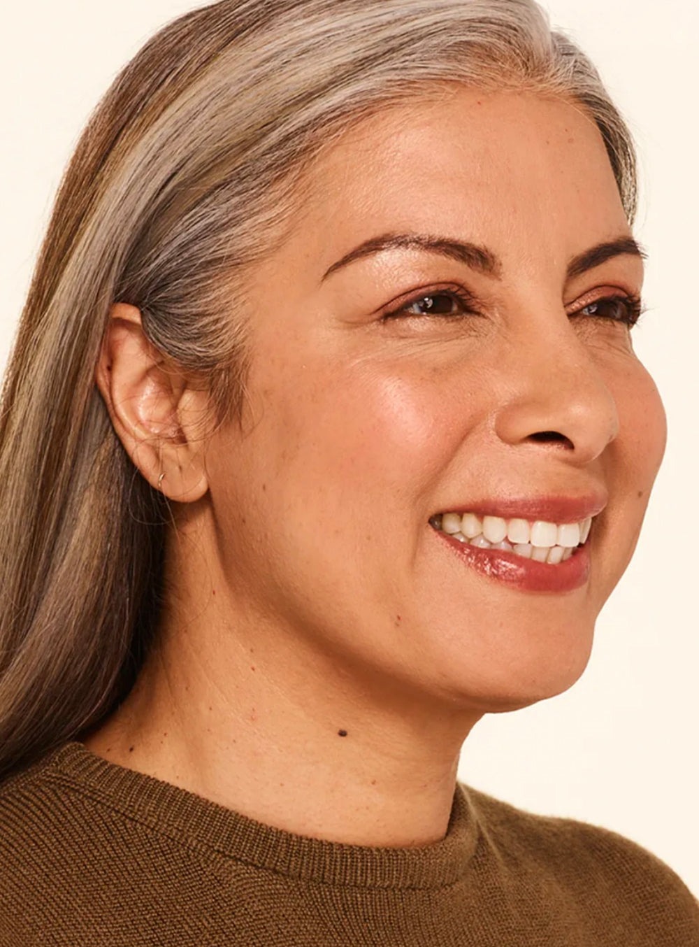 After wrinkle relaxer treatment showing smoother skin and reduced fine lines in St. Augustine, FL
