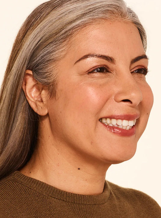 After wrinkle relaxer treatment showing smoother skin and reduced fine lines in St. Augustine, FL