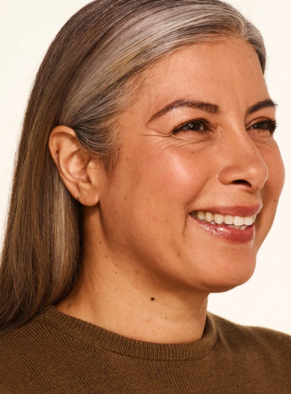 Before wrinkle relaxer treatment showing visible fine lines and facial wrinkles in St. Augustine, FL