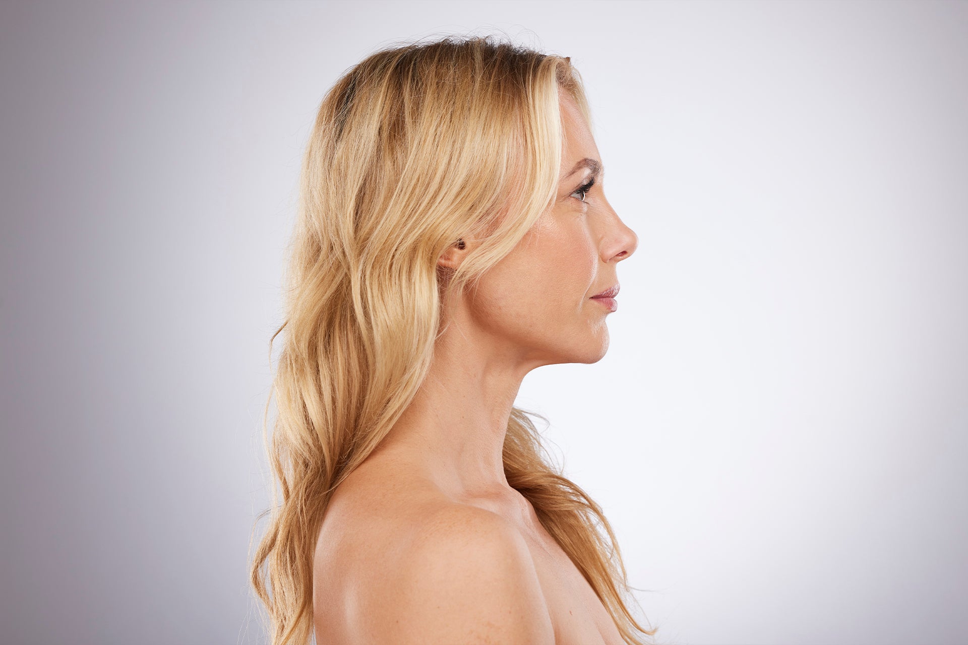 Side profile of natural facial features representing refined aesthetic balance after Kybella treatment