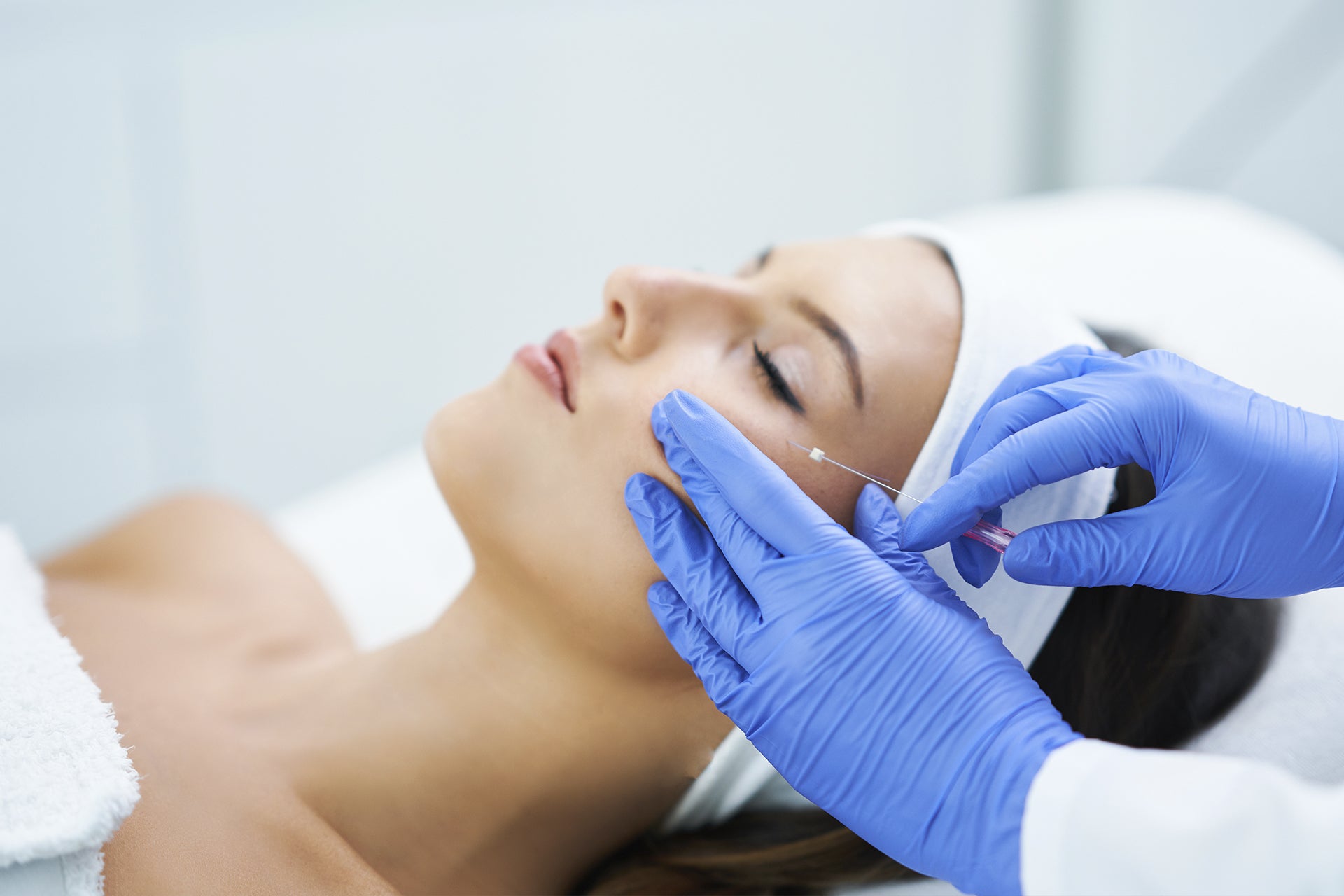 PDO thread lift treatment being performed on the jawline with fine threads placed under the skin to lift, tighten, and stimulate collagen for a non-surgical facial rejuvenation.