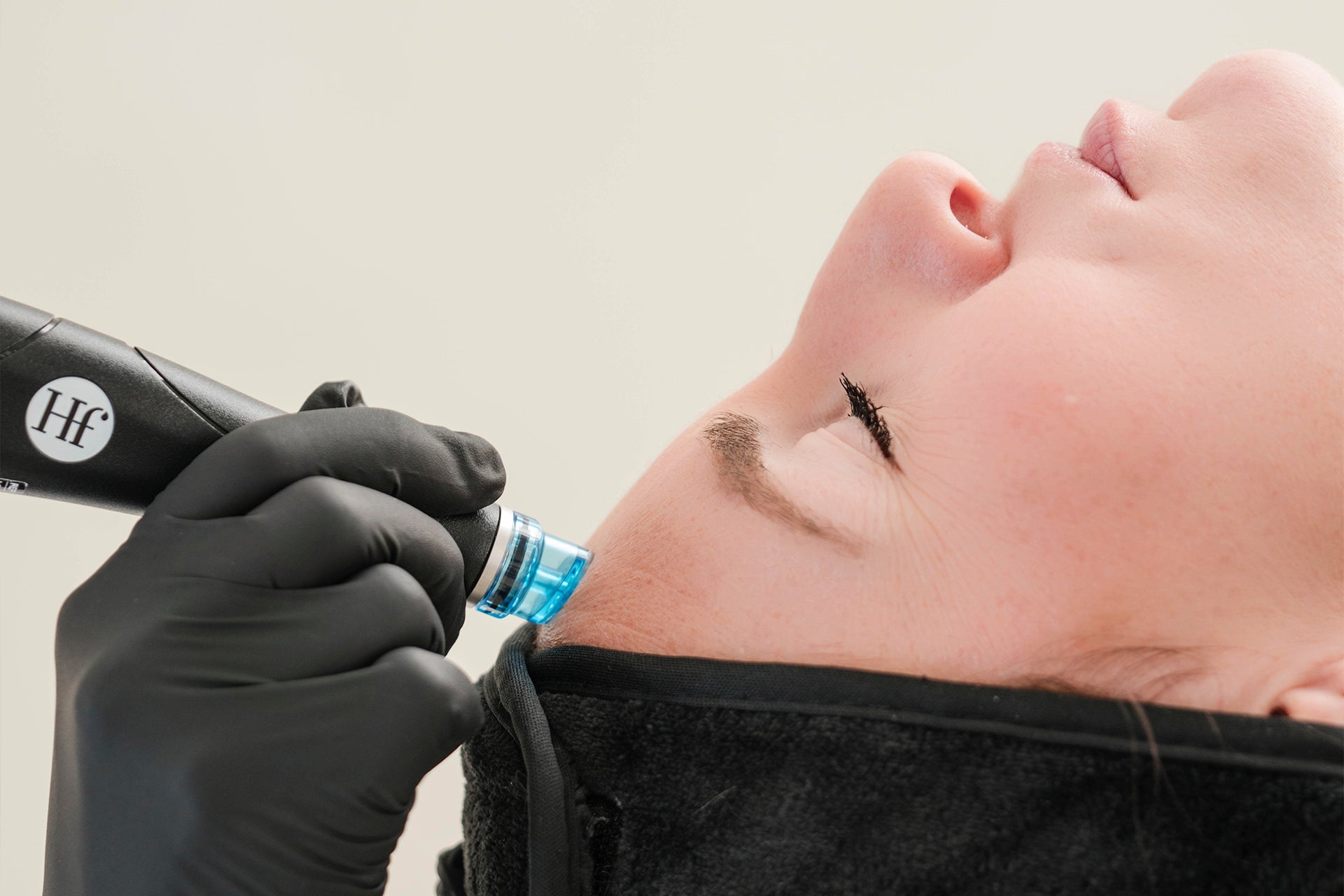 HydraFacial treatment exfoliating and cleansing the skin performed by a licensed aesthetic provider in St. Augustine Florida